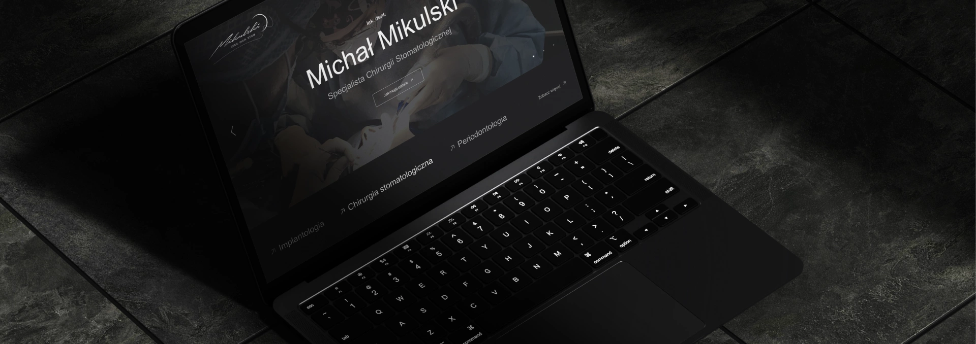 Nowoczesny laptop wyświetlający portal dla pacjentów i specjalistów. Widoczne sekcje: chirurgia stomatologiczna, implantologia, periodontologia.